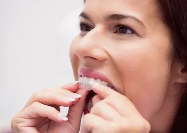Can You Chew Gum With Invisalign? Pros And Cons