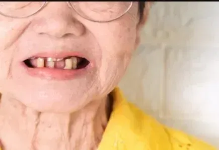 My Teeth Are Breaking Into Pieces: Complete Guide to Causes & Solutions (2026)