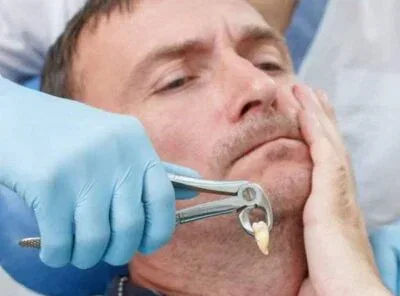 Day-by-Day Tooth Extraction Healing Stages with Pictures: Your Visual Guide to Normal Recovery 2026