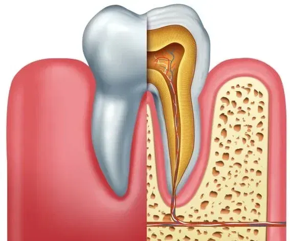 Tooth with Root Canal Hurts with Pressure: Months and Years Later