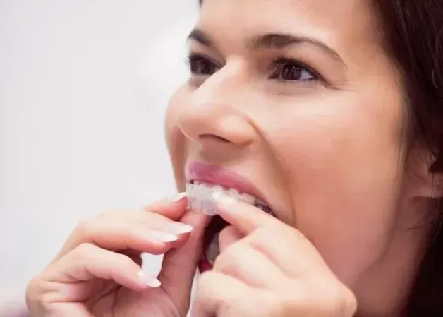 Can You Chew Gum With Invisalign? Pros And Cons