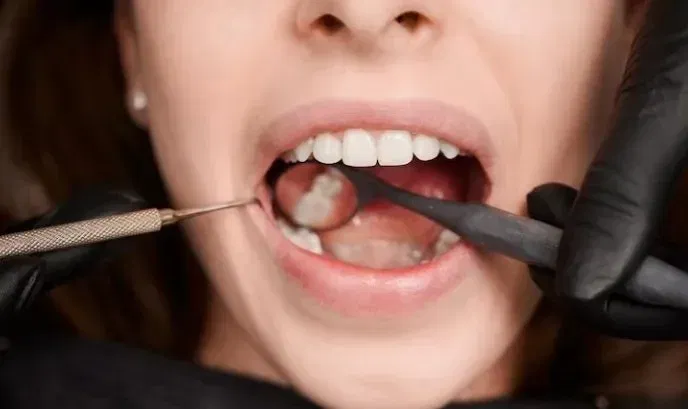 Why Does My Filling Hurt After Months? 7 Reasons For Filling Pain