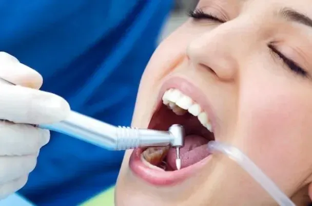 Tooth Filling Fell Out With No Pain? Don’t Wait Long – Here’s The Emergency Fix