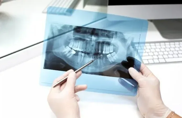 Xray of Child’s Teeth: Should the pediatric dentist Do It?