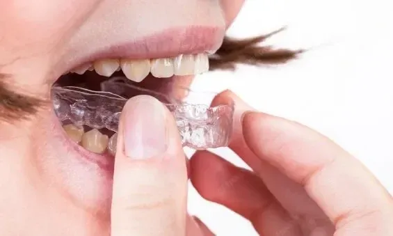 Best Night Guard For Teeth Grinding and With Braces 2023 Full Guide