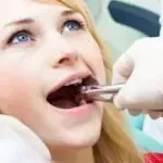 How to Prepare For Wisdom Teeth Removal?…