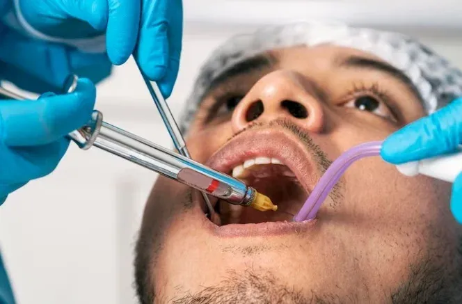 I Need a Tooth Pulled Immediately: When Not to Do It and How to