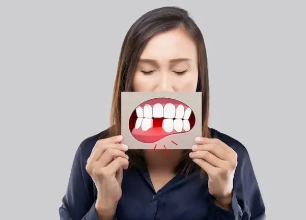 My Tooth Chipped Off For No Reason: Causes and Treatments