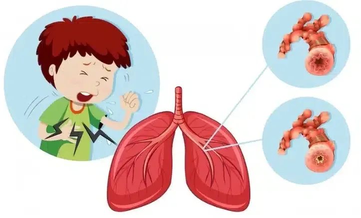 What Does Lung Cancer Breath Smell Like? Types of Bad Breath Smells